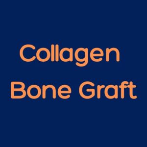 Xenobone® – High-Purity Collagen Bone Graft for Accelerated Bone Regeneration